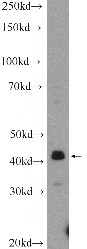 mouse eye tissue were subjected to SDS PAGE followed by western blot with Catalog No:116804(VSX2 Antibody) at dilution of 1:600