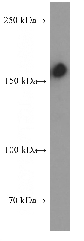 Jurkat cells were subjected to SDS PAGE followed by western blot with Catalog No:107038(CD109 Antibody) at dilution of 1:4000