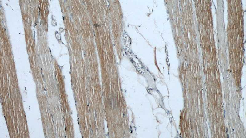 Immunohistochemical of paraffin-embedded human skeletal muscle using Catalog No:115272(SHF antibody) at dilution of 1:50 (under 10x lens)