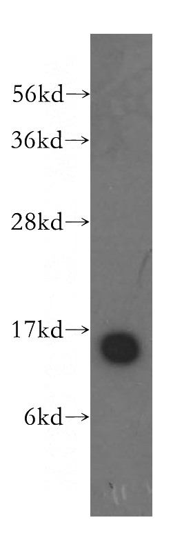 HeLa cells were subjected to SDS PAGE followed by western blot with Catalog No:116041(THEM2 antibody) at dilution of 1:500
