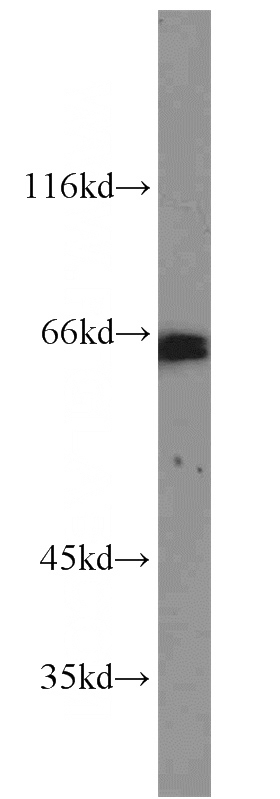 HEK-293 cells were subjected to SDS PAGE followed by western blot with Catalog No:110884(GATA6 antibody) at dilution of 1:500