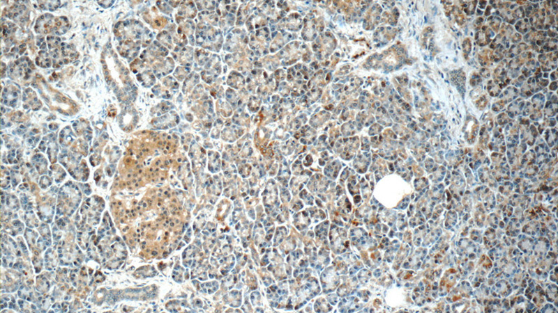Immunohistochemistry of paraffin-embedded human pancreas slide using Catalog No:107965(ALDH1L2 Antibody) at dilution of 1:50