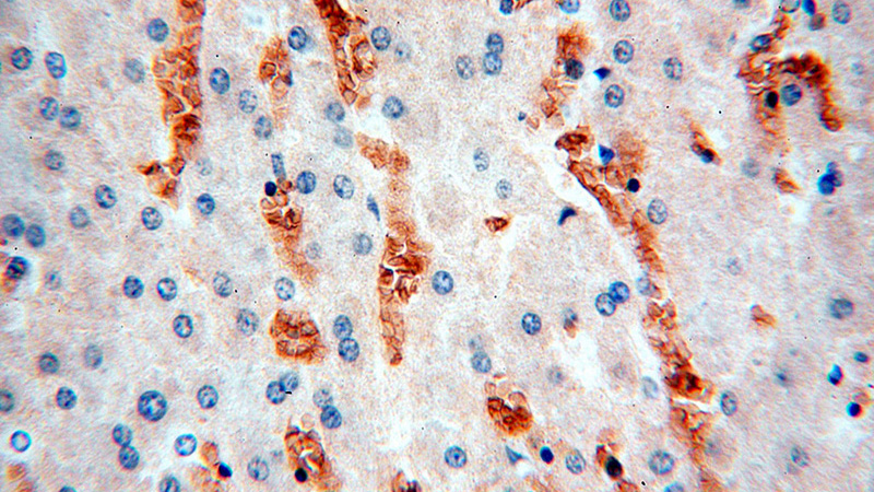 Immunohistochemical of paraffin-embedded human liver using Catalog No:111276(HBZ antibody) at dilution of 1:100 (under 40x lens)