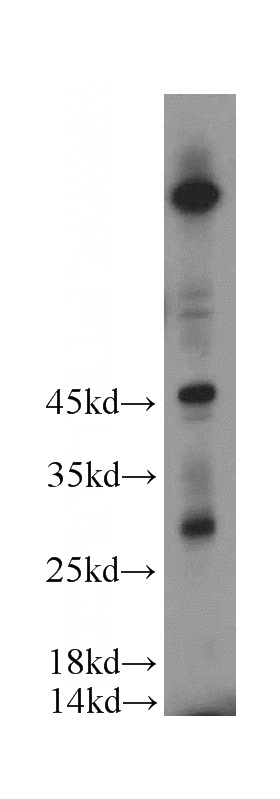 HeLa cells were subjected to SDS PAGE followed by western blot with Catalog No:110580(FAM185A antibody) at dilution of 1:500