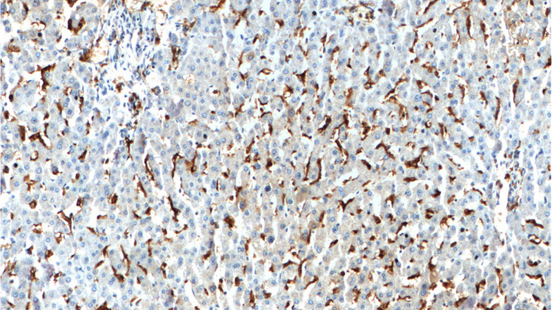 Immunohistochemistry of paraffin-embedded human liver tissue slide using Catalog No:109058(CD16 Antibody) at dilution of 1:200 (under 10x lens).
