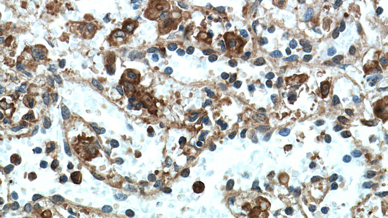 Immunohistochemical of paraffin-embedded human spleen using Catalog No:109041(CD11B antibody) at dilution of 1:50 (under 40x lens)