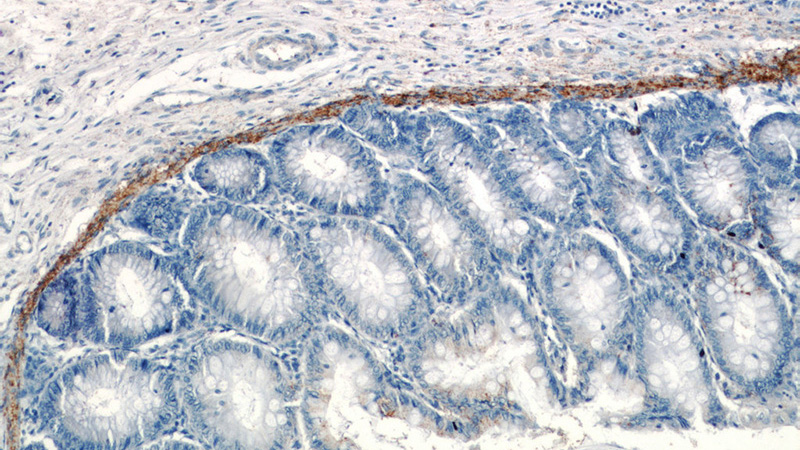 Immunohistochemistry of paraffin-embedded human colon tissue slide using Catalog No:116810(VWA2 Antibody) at dilution of 1:50