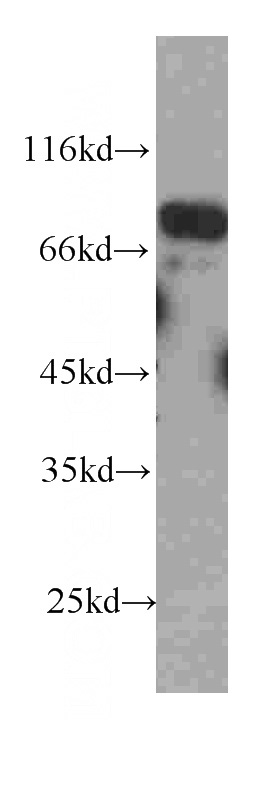 HEK-293 cells were subjected to SDS PAGE followed by western blot with Catalog No:107201(FAF1 antibody) at dilution of 1:1000