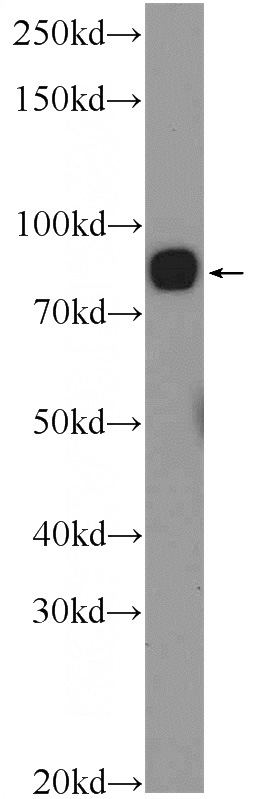 HeLa cells were subjected to SDS PAGE followed by western blot with Catalog No:113779(PGBD1 Antibody) at dilution of 1:600