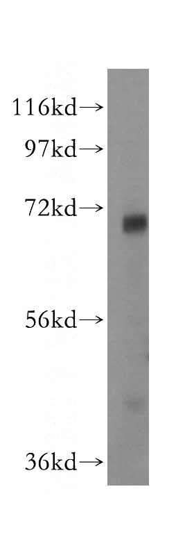 mouse liver tissue were subjected to SDS PAGE followed by western blot with Catalog No:111183(GSTCD antibody) at dilution of 1:500
