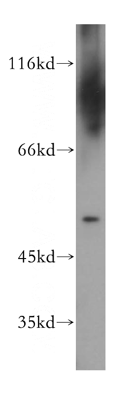 human testis tissue were subjected to SDS PAGE followed by western blot with Catalog No:107898(AEBP2 antibody) at dilution of 1:100