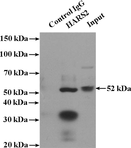 IP Result of anti-HARS2 (IP:Catalog No:111257, 4ug; Detection:Catalog No:111257 1:500) with HEK-293 cells lysate 3000ug.