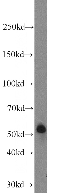 COLO 320 cells were subjected to SDS PAGE followed by western blot with Catalog No:116274(TMPRSS2 antibody) at dilution of 1:1000