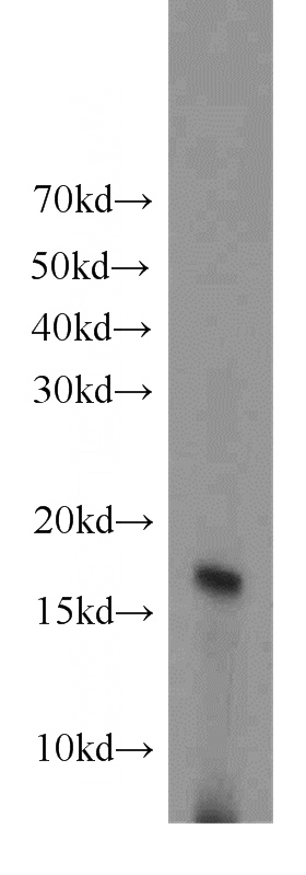 A431 cells were subjected to SDS PAGE followed by western blot with Catalog No:111407(H3F3A antibody) at dilution of 1:400