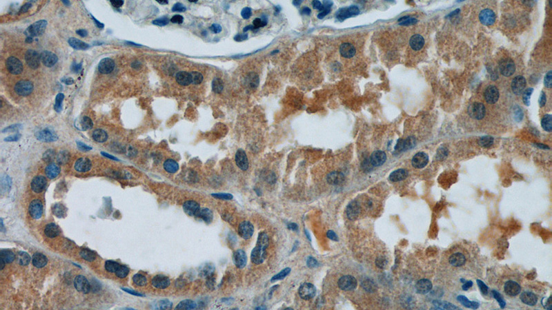 Immunohistochemistry of paraffin-embedded human kidney tissue slide using Catalog No:112440(MAPKAPK2 Antibody) at dilution of 1:50 (under 40x lens)