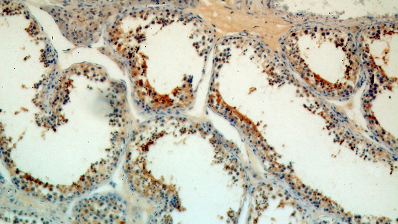 Immunohistochemical of paraffin-embedded human testis using Catalog No:109563(CRISP2 antibody) at dilution of 1:50 (under 10x lens)