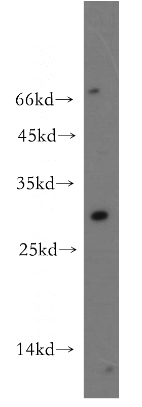 mouse kidney tissue were subjected to SDS PAGE followed by western blot with Catalog No:110014(DRAP1 antibody) at dilution of 1:300