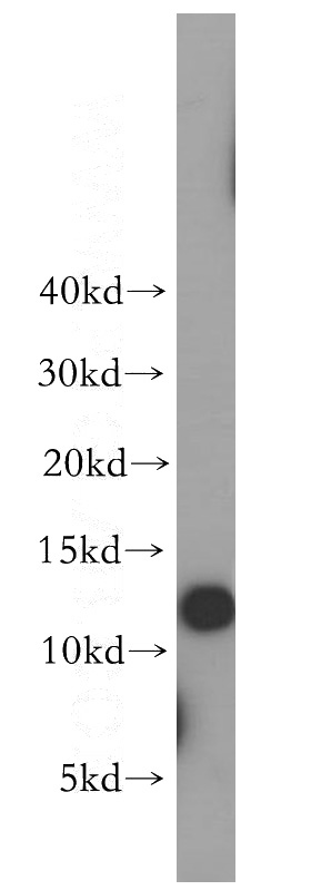human kidney tissue were subjected to SDS PAGE followed by western blot with Catalog No:116135(TIMM8A antibody) at dilution of 1:500