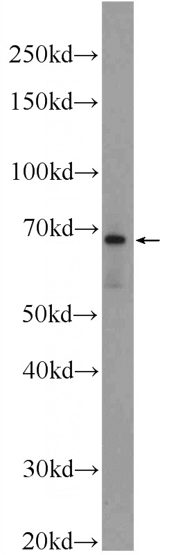 mouse kidney tissue were subjected to SDS PAGE followed by western blot with Catalog No:112145(LARGE Antibody) at dilution of 1:1000