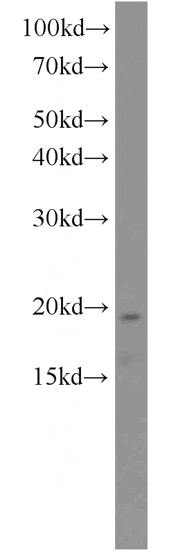 L02 cells were subjected to SDS PAGE followed by western blot with Catalog No:113734(PFDN2 antibody) at dilution of 1:300