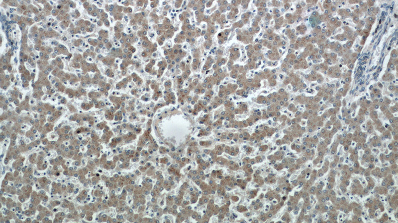 Immunohistochemical of paraffin-embedded human liver using Catalog No:113017(NAGS antibody) at dilution of 1:50 (under 10x lens)