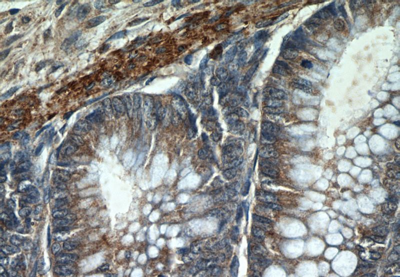 Immunohistochemistry of paraffin-embedded human colon tissue slide using Catalog No:111347(HIGD1B Antibody) at dilution of 1:50 (under 40x lens)