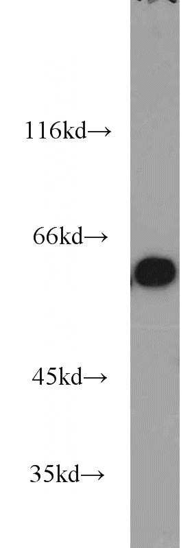 HEK-293 cells were subjected to SDS PAGE followed by western blot with Catalog No:108332(ATL2 antibody) at dilution of 1:1200