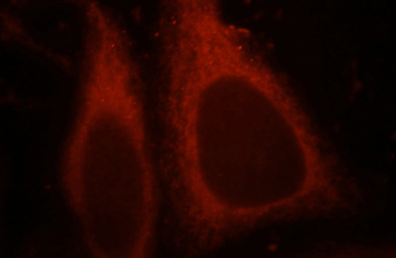 Immunofluorescent analysis of HepG2 cells, using CHIA antibody Catalog No:109226 at 1:25 dilution and Rhodamine-labeled goat anti-rabbit IgG (red).