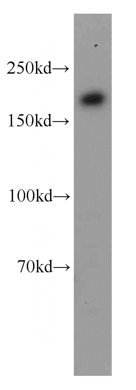 PC-3 cells were subjected to SDS PAGE followed by western blot with Catalog No:113901(PIK3C2A antibody) at dilution of 1:1500