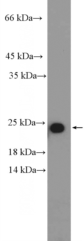 HeLa cells were subjected to SDS PAGE followed by western blot with Catalog No:114818(RPL18 Antibody) at dilution of 1:600