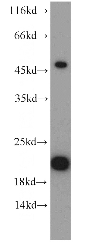 mouse brain tissue were subjected to SDS PAGE followed by western blot with Catalog No:116709(VAMP7 antibody) at dilution of 1:1000