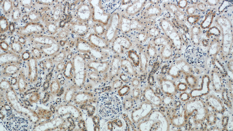 Immunohistochemical of paraffin-embedded human kidney using Catalog No:115375(SLC38A4 antibody) at dilution of 1:50 (under 10x lens)