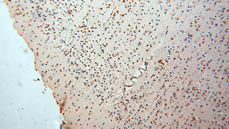 Immunohistochemical of paraffin-embedded human brain using Catalog No:112634(MEF2C antibody) at dilution of 1:50 (under 10x lens)