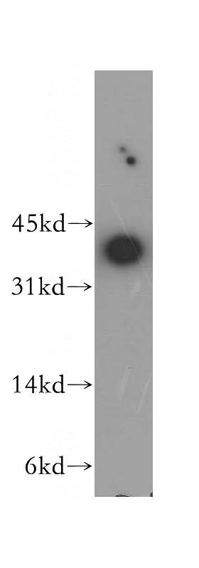 HEK-293 cells were subjected to SDS PAGE followed by western blot with Catalog No:112664(MKI67IP antibody) at dilution of 1:500
