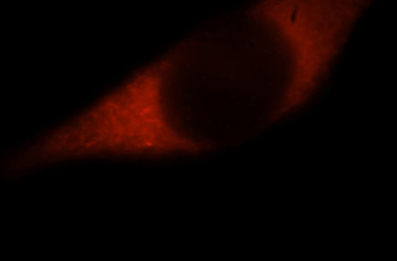 Immunofluorescent analysis of MCF-7 cells, using HDLBP antibody Catalog No:111390 at 1:25 dilution and Rhodamine-labeled goat anti-rabbit IgG (red).