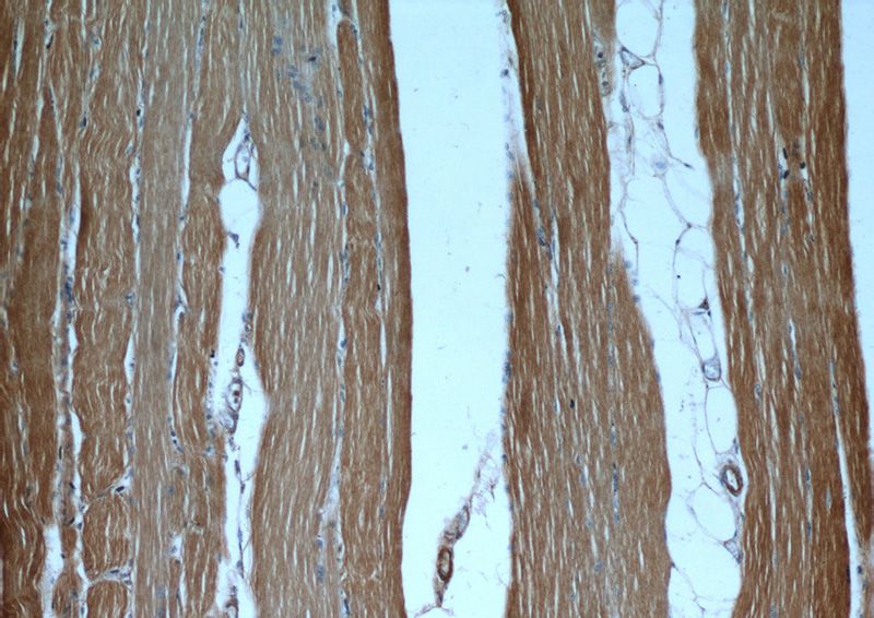 Immunohistochemical of paraffin-embedded human skeletal muscle using Catalog No:108917(CAMK2B antibody) at dilution of 1:50 (under 10x lens)