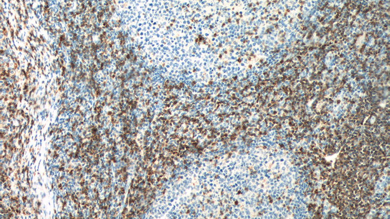 Immunohistochemistry of paraffin-embedded human tonsillitis tissue slide using Catalog No:107142(CD7 Antibody) at dilution of 1:200 (under 10x lens). heat mediated antigen retrieved with Tris-EDTA buffer(pH9).