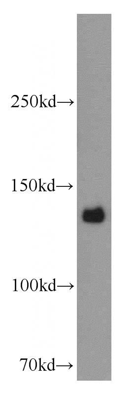 HeLa cells were subjected to SDS PAGE followed by western blot with Catalog No:109251(CENPC1 antibody) at dilution of 1:800