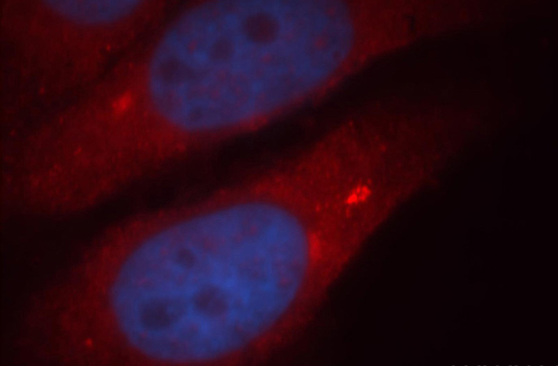 Immunofluorescent analysis of HepG2 cells, using PIK3R5 antibody Catalog No:113869 at 1:25 dilution and Rhodamine-labeled goat anti-rabbit IgG (red). Blue pseudocolor = DAPI (fluorescent DNA dye).