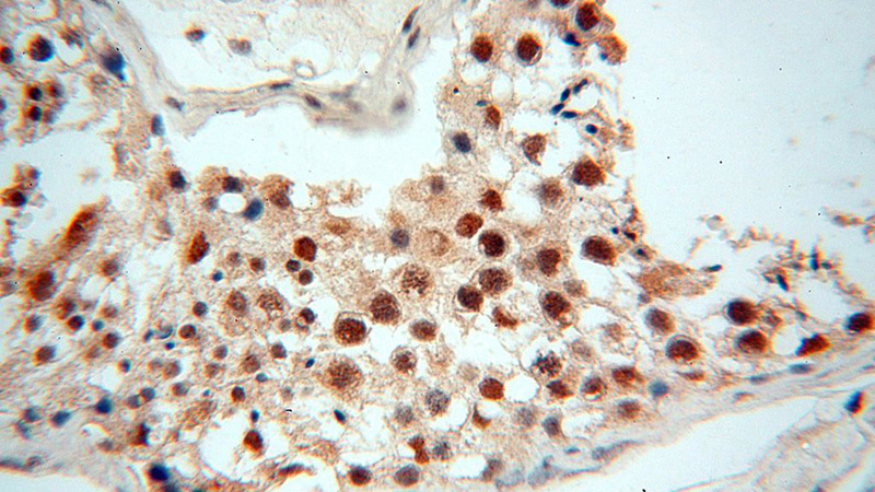 Immunohistochemical of paraffin-embedded human testis using Catalog No:116839(WRAP53 antibody) at dilution of 1:100 (under 40x lens)