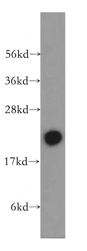 mouse testis tissue were subjected to SDS PAGE followed by western blot with Catalog No:114594(RBBP9 antibody) at dilution of 1:400