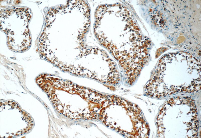 Immunohistochemistry of paraffin-embedded human testis tissue slide using Catalog No:109182(CEP55 Antibody) at dilution of 1:50 (under 10x lens)
