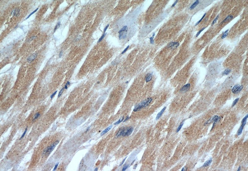 Immunohistochemical of paraffin-embedded human heart using Catalog No:108859(TNNI3 antibody) at dilution of 1:50 (under 40x lens)