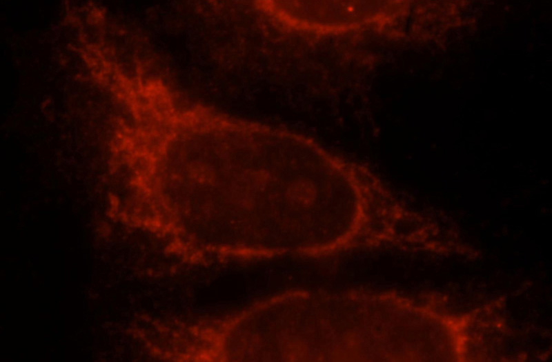Immunofluorescent analysis of Hela cells, using GLB1 antibody Catalog No:117127 at 1:25 dilution and Rhodamine-labeled goat anti-rabbit IgG (red).