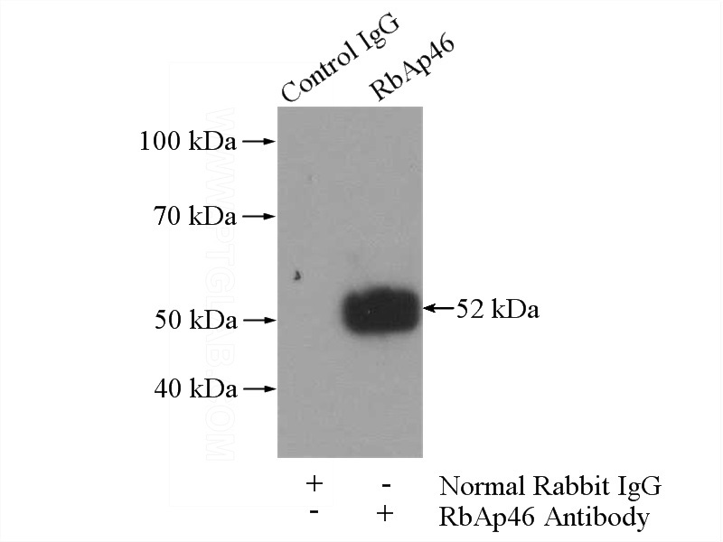 IP Result of anti-RBBP7 (IP:Catalog No:114588, 4ug; Detection:Catalog No:114588 1:300) with A431 cells lysate 2400ug.