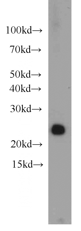 HeLa cells were subjected to SDS PAGE followed by western blot with Catalog No:111494(HN1 antibody) at dilution of 1:1000