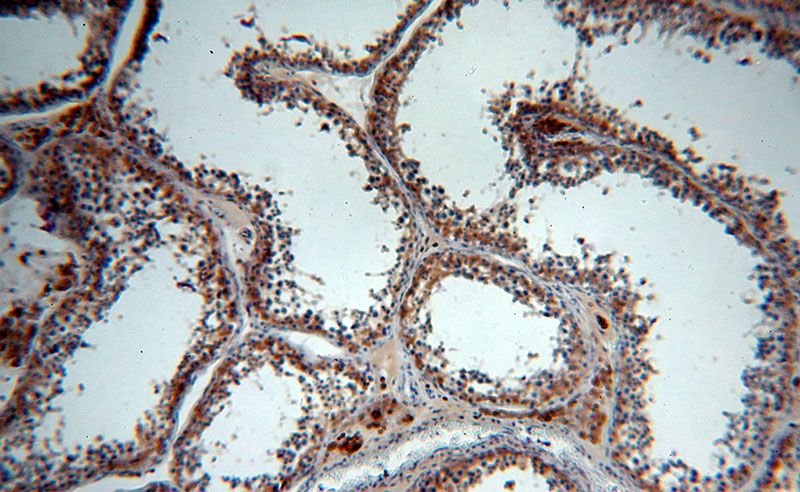 Immunohistochemical of paraffin-embedded human testis using Catalog No:114237(PRPS1 antibody) at dilution of 1:50 (under 10x lens)