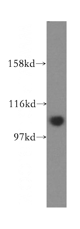 HeLa cells were subjected to SDS PAGE followed by western blot with Catalog No:111873(INTS4 antibody) at dilution of 1:500