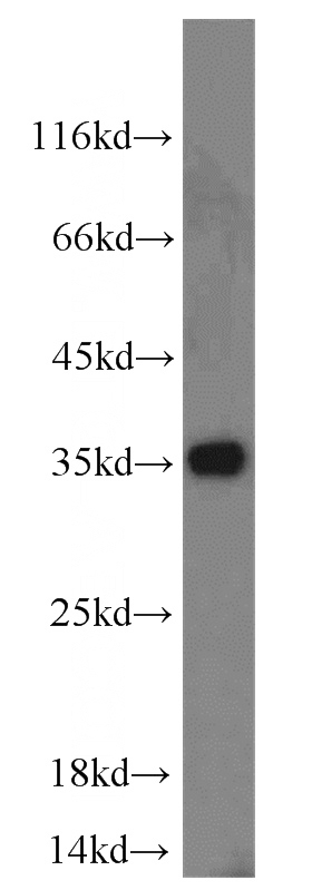 A431 cells were subjected to SDS PAGE followed by western blot with Catalog No:115835(SUMF2 antibody) at dilution of 1:500