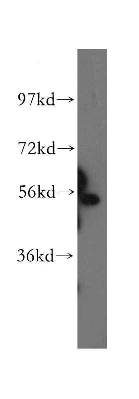 PC-3 cells were subjected to SDS PAGE followed by western blot with Catalog No:111302(HEXA antibody) at dilution of 1:500